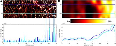 Ice Core Science Meets Computer Vision: Challenges and Perspectives